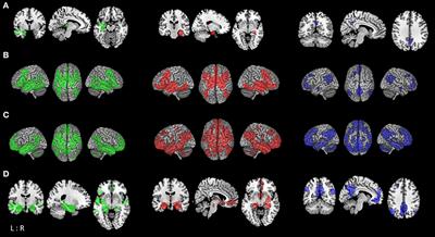 Functional Characterization of Atrophy Patterns Related to Cognitive Impairment
